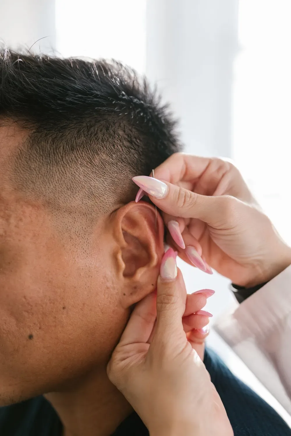 Praticienne posant une aiguille d'auriculothérapie sur l'oreille d'un patient